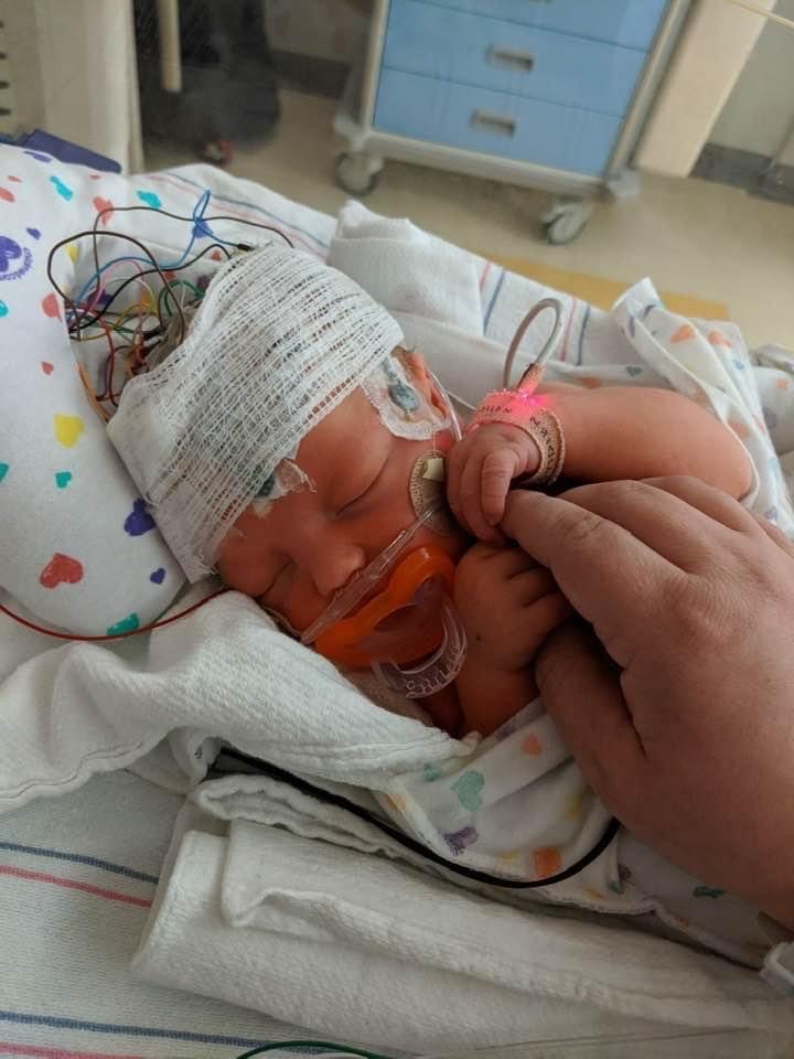Newborn Colton in the hospital with many medical monitoring devices connected to him.